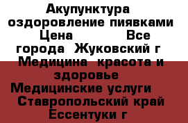 Акупунктура, оздоровление пиявками › Цена ­ 3 000 - Все города, Жуковский г. Медицина, красота и здоровье » Медицинские услуги   . Ставропольский край,Ессентуки г.